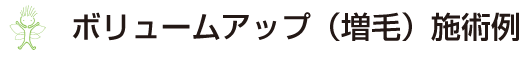 自然な増毛